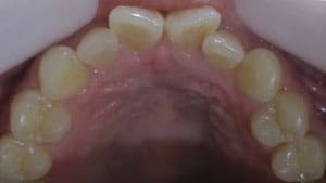 藤沢デンタルオフィスのマウスピース矯正